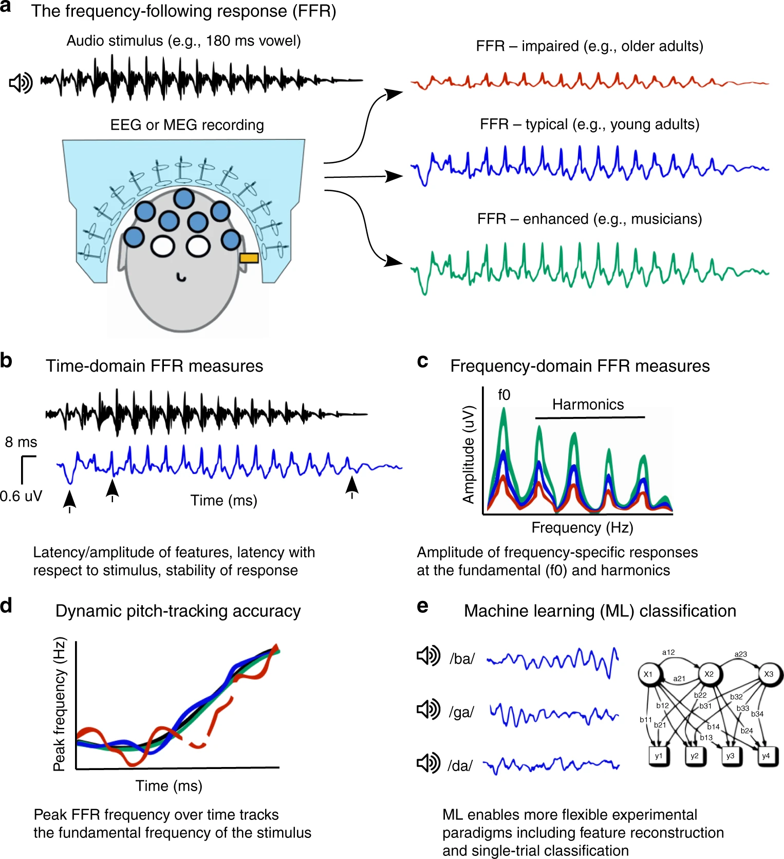 The Frequency Following Response and Machine-Learning